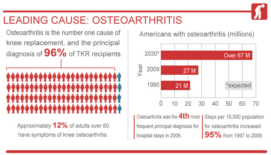 Breakthrough Tech Offers Alternatives to Knee Replacement